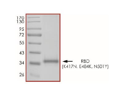 The purity of 2019-nCoV Spike protein S1 subunit, RBD (K417N, E484K, N501Y) was determined to be >90% by densitometry